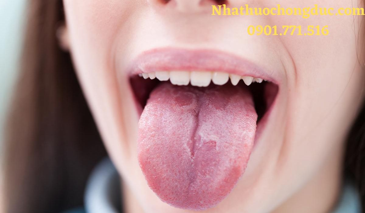 Ung thư lưỡi: Nguyên nhân, phòng và cách điều trị